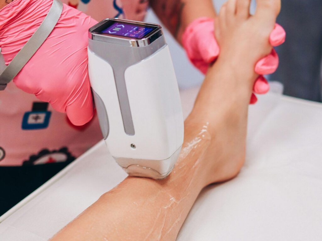 colori di peli per l'epilazione laser