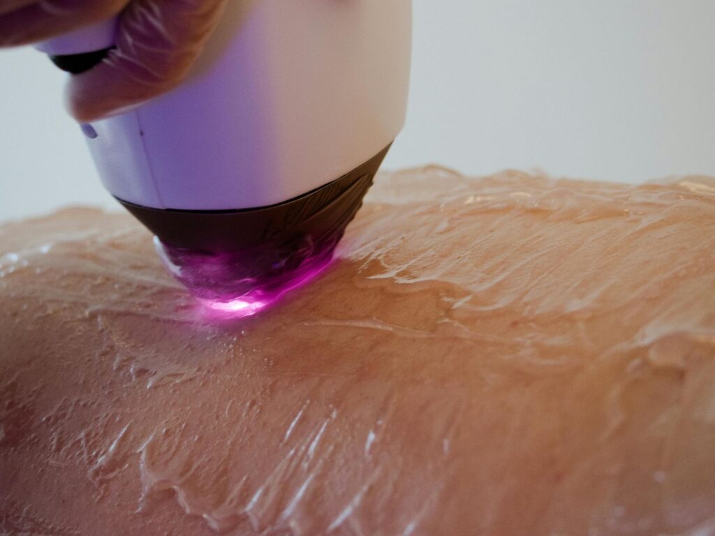 quanto è igienico il laser